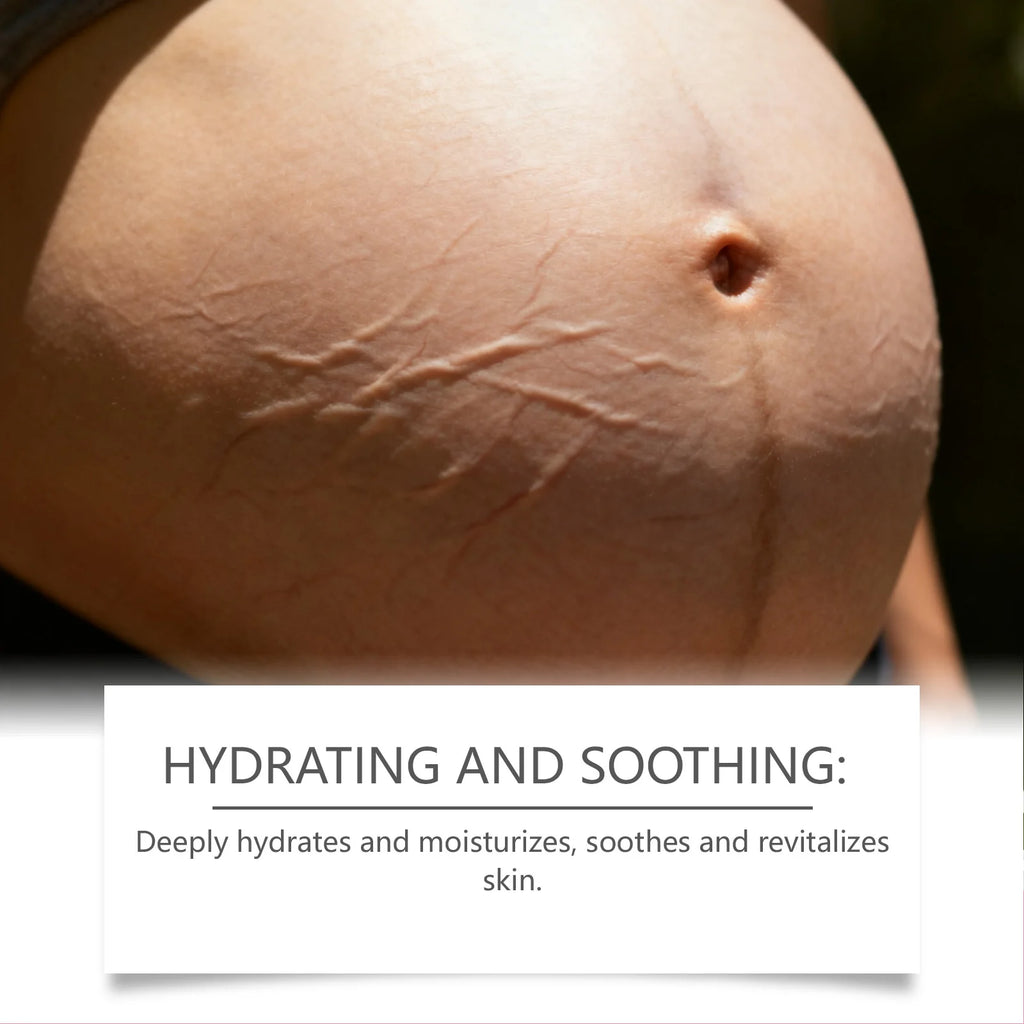 OceAura Pregnancy Stretch Mark Cream — Deep Hydration, Skin Regeneration & Non-Greasy Formula 100g