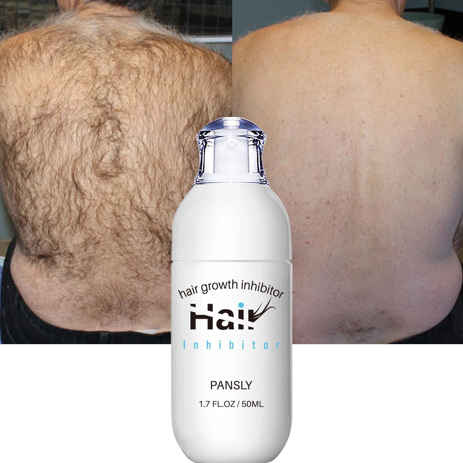 Painless Hair Growth Inhibitor Spray — 100ml