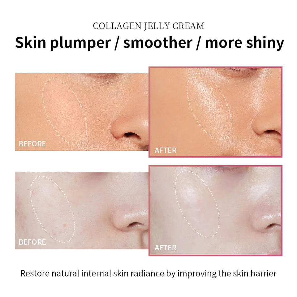 Niacinamide Collagen Jelly Firming Face Cream
