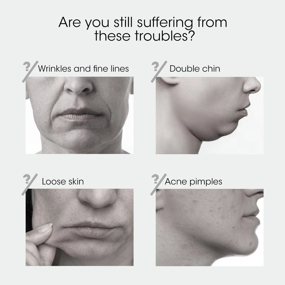 Hailicare V-Face Lifting Massager – Rechargeable Facial Slimming Device with Remote Control