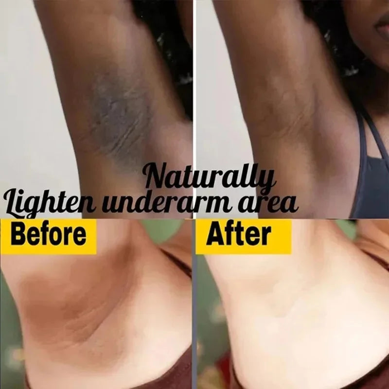 Body Whitening & Brightening Soap Bar – Bleaching Scrub for Knees, Armpits & Intimate Areas