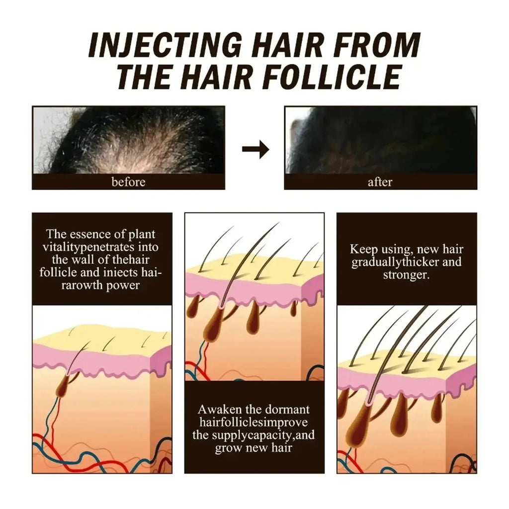 Black Rice Fast Hair Growth Serum Spray for Men Women Anti-loss Hair Regrowth Essential Oil Scalp Treatment Hair Care Products
