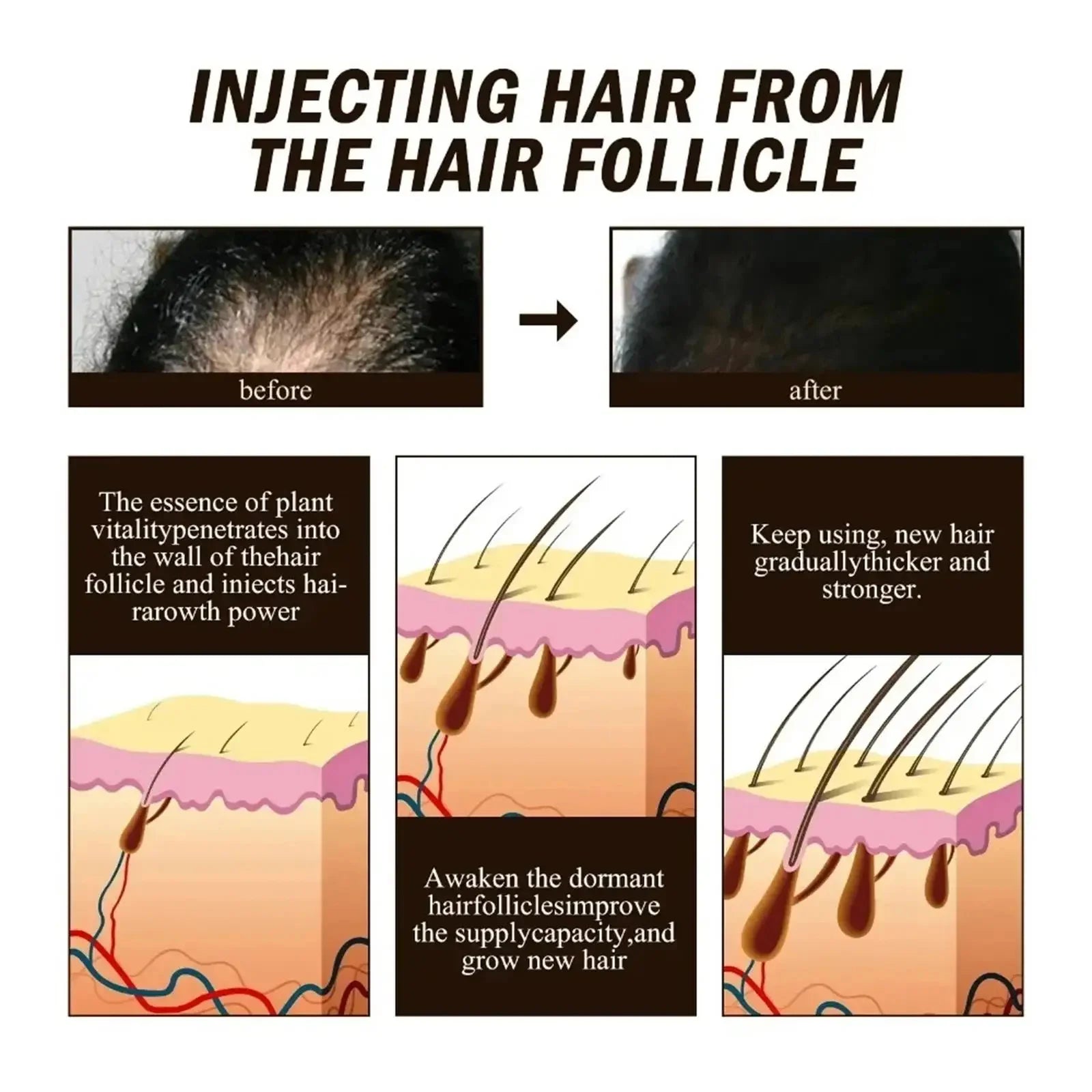 Black Rice Fast Hair Growth Serum Spray for Men Women Anti-loss Hair Regrowth Essential Oil Scalp Treatment Hair Care Products