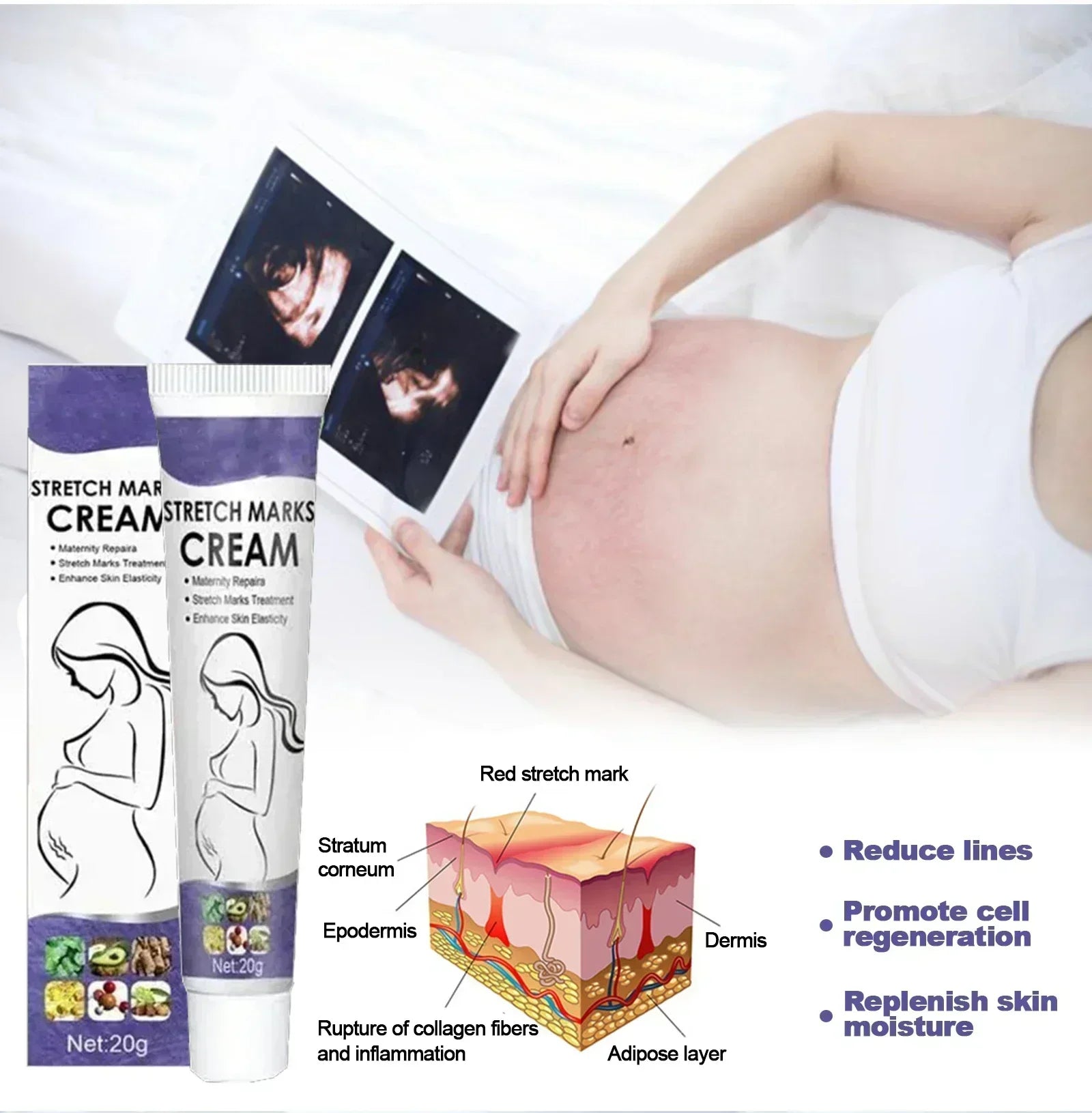 Stretch Mark Vanishing Cream — Buttock, Breast & Body Mark Repair, Firming Maternity Skin Care