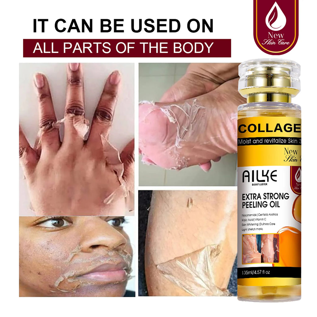 AILKE Collagen Yellow Peeling Oil — Stretch Mark Removal, Brightening & Gentle Exfoliation 135ml