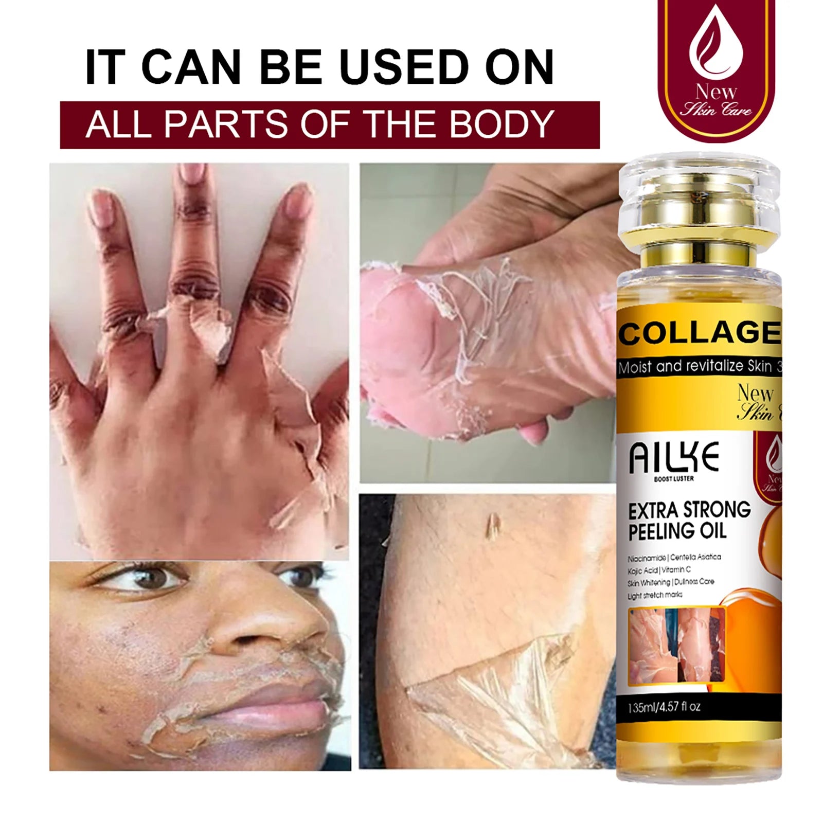 AILKE Collagen Yellow Peeling Oil — Stretch Mark Removal, Brightening & Gentle Exfoliation 135ml