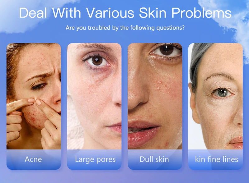 LCD Skin Moisture & Oil Analyzer Pen – Fluorescent Agent Detector, Elasticity & Skin Age Tester