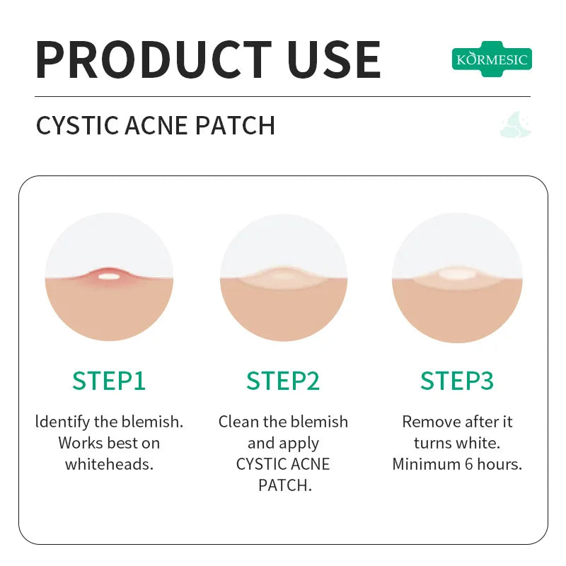 Invisible Acne Pimple Patch — Concealer Spot Stickers for Clear Skin
