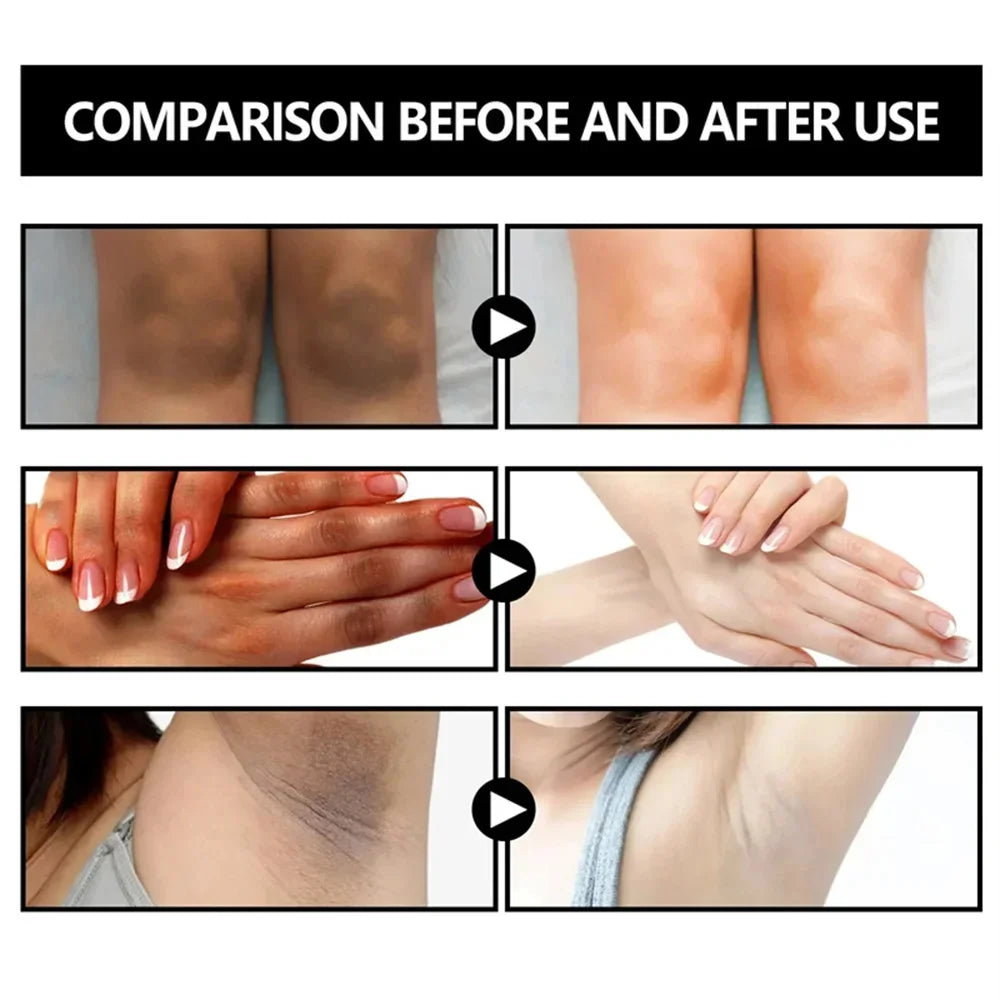Body Whitening & Brightening Soap Bar – Bleaching Scrub for Knees, Armpits & Intimate Areas