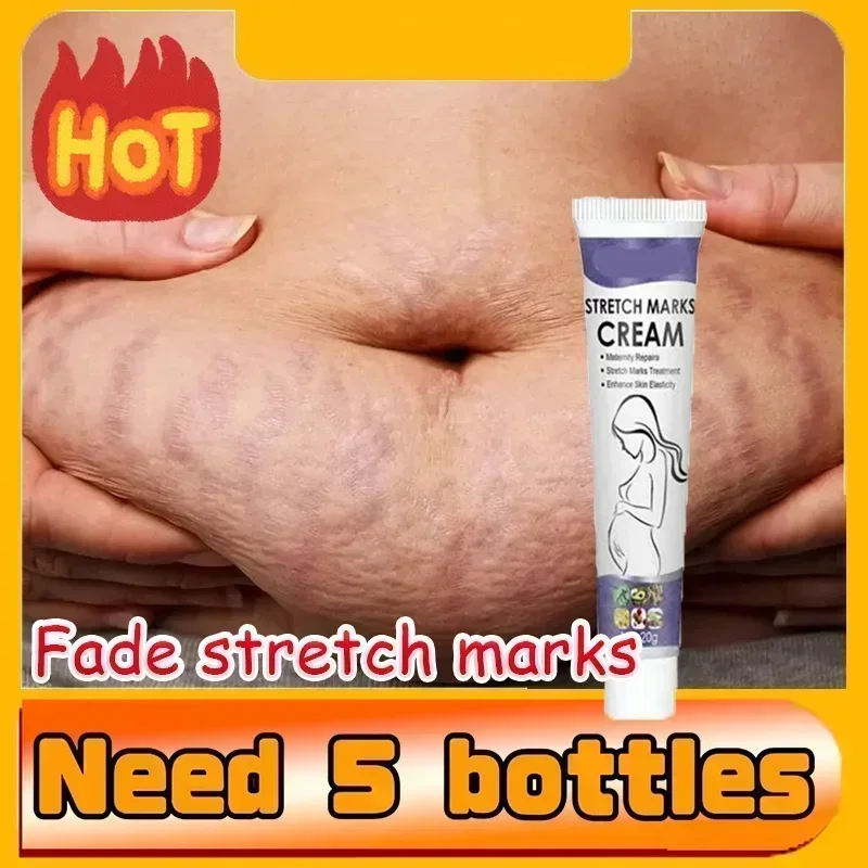 Stretch Marks Treatment & Repair Body Oil — Anti-Wrinkle Skin Care Oil for Maternity & Postpartum