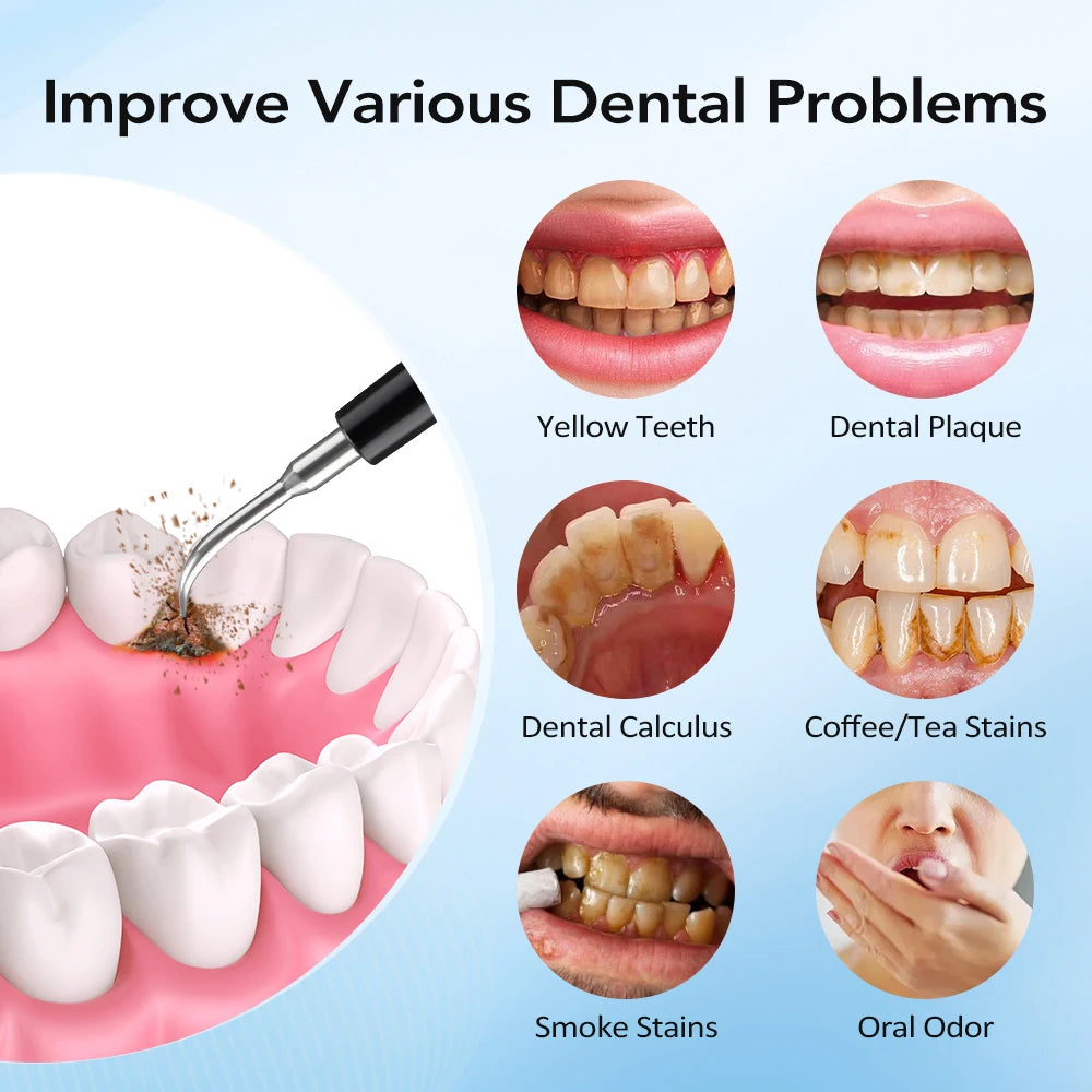 Dentist-Level Clean at Home — Electric Teeth Cleaner & Tartar Remover | 6-Gear Modes, 31,000 Vibrations/Min, IPX6 Waterproof, Type-C Charging
