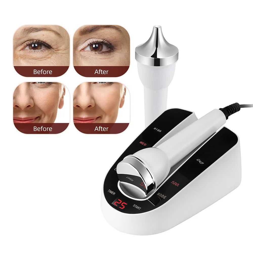 1MHz Ultrasonic Facial Beauty Machine – Lifting, Anti-Aging, Skin Tightening & Eye Care SPA Device