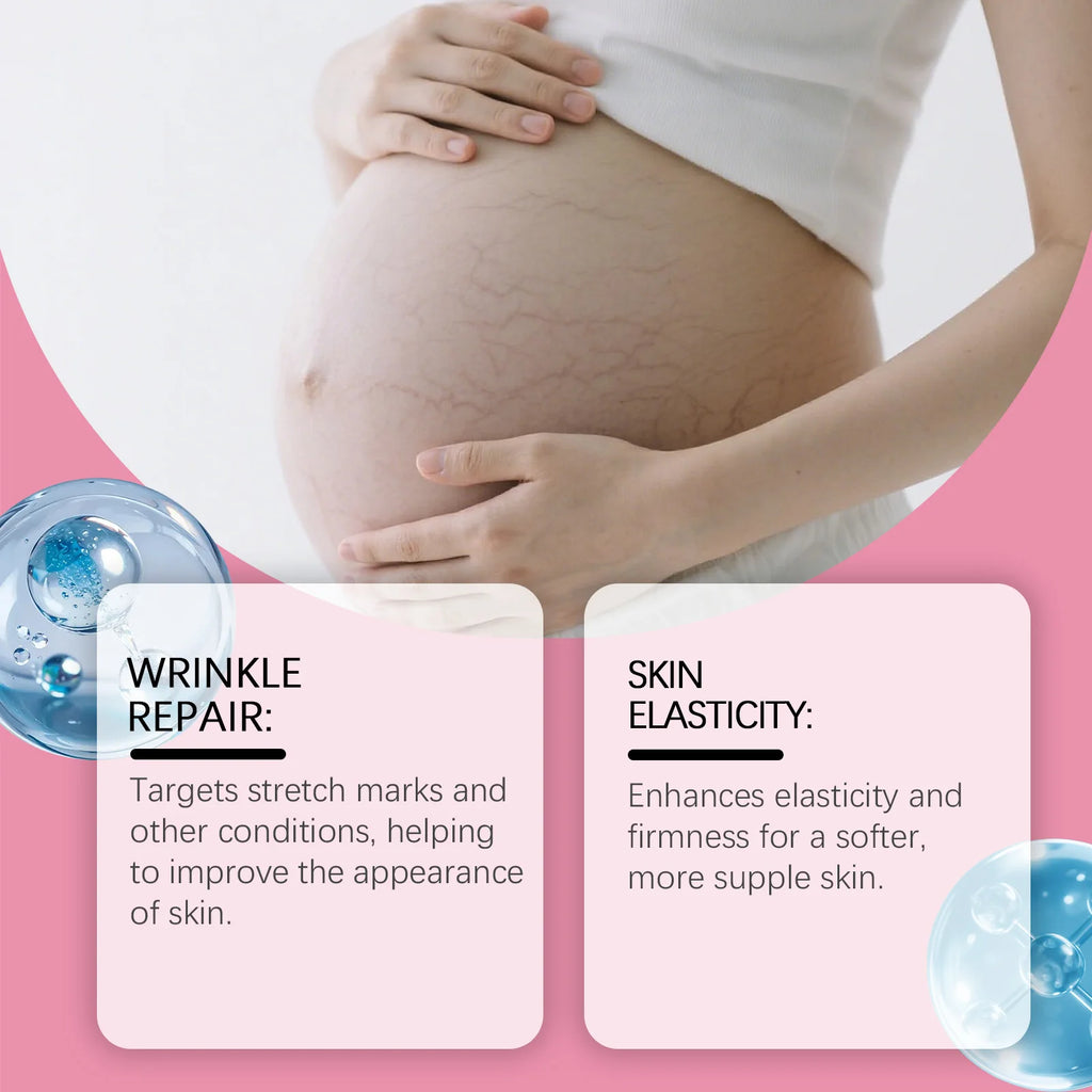 OceAura Pregnancy Stretch Mark Cream — Deep Hydration, Skin Regeneration & Non-Greasy Formula 100g