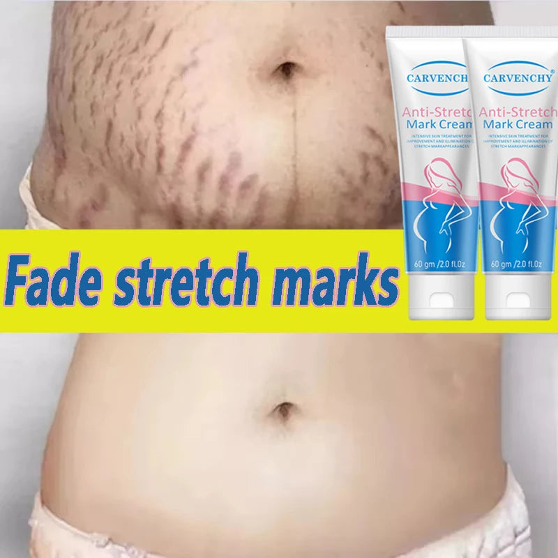 Snail Removes Stretch Mark Cream — Postpartum Firming, Anti-Aging & Wrinkle Repair Body Cream 60g