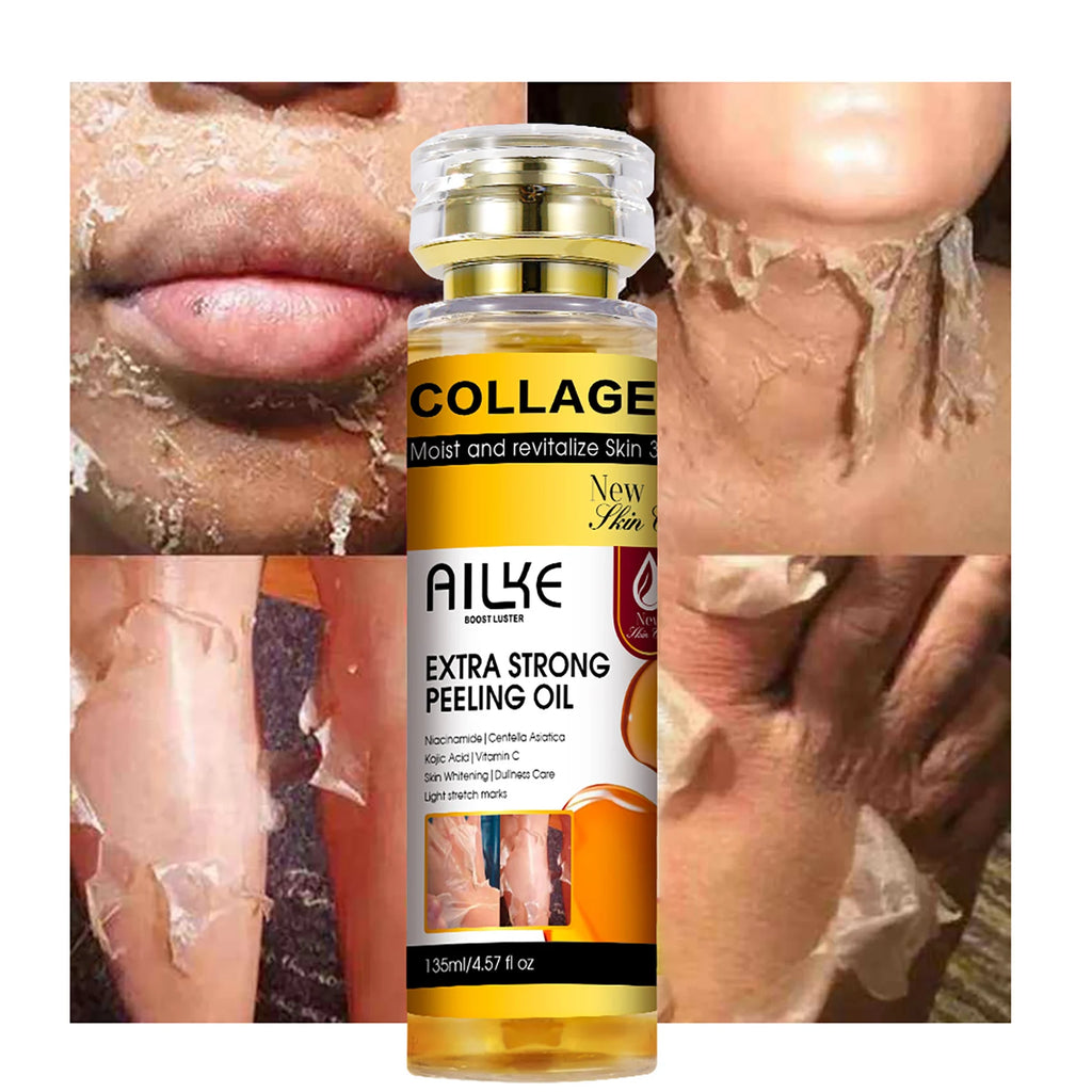 AILKE Collagen Yellow Peeling Oil — Stretch Mark Removal, Brightening & Gentle Exfoliation 135ml