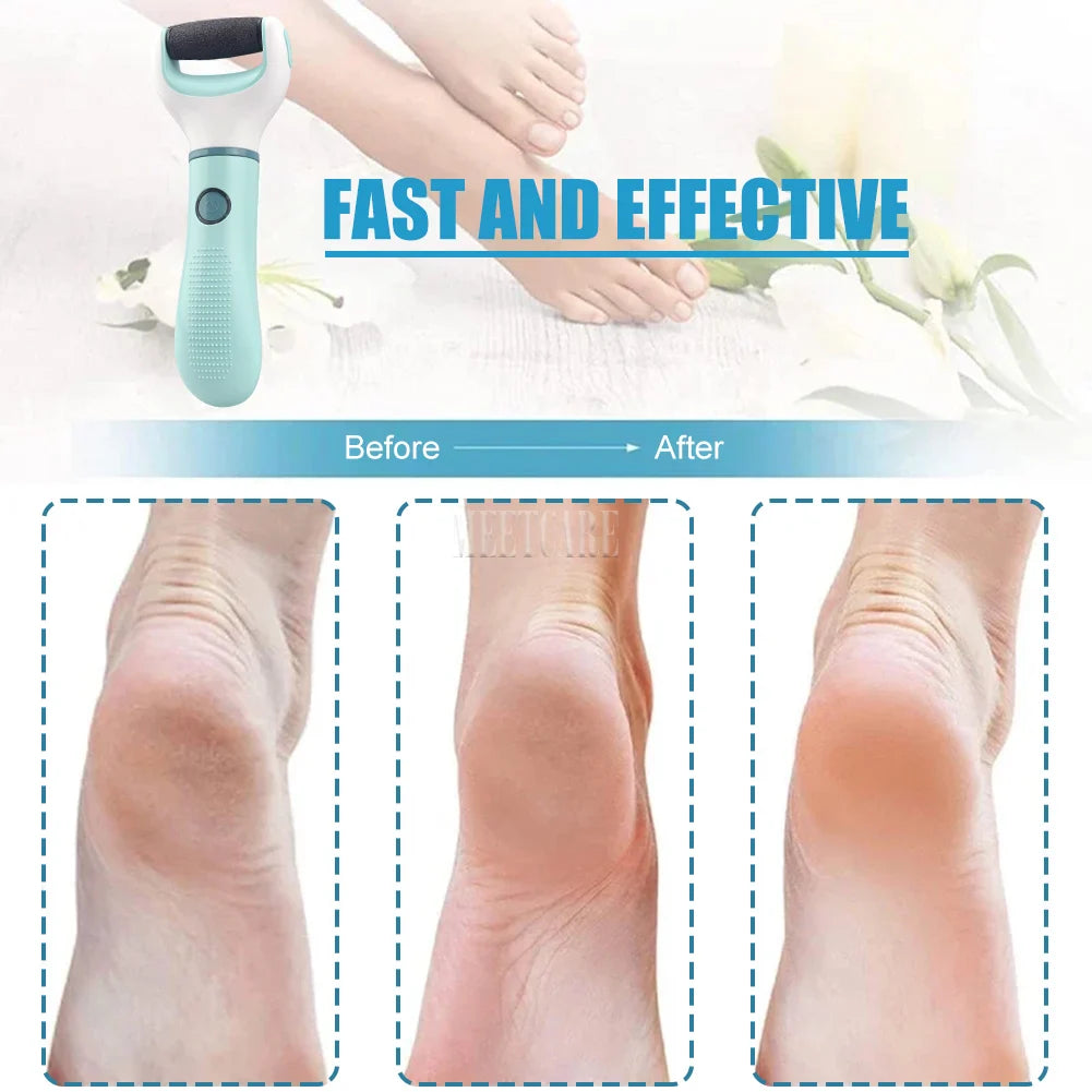 Electric Foot Grinder & Callus Remover – Dead Skin Scrubber for Cracked Heels