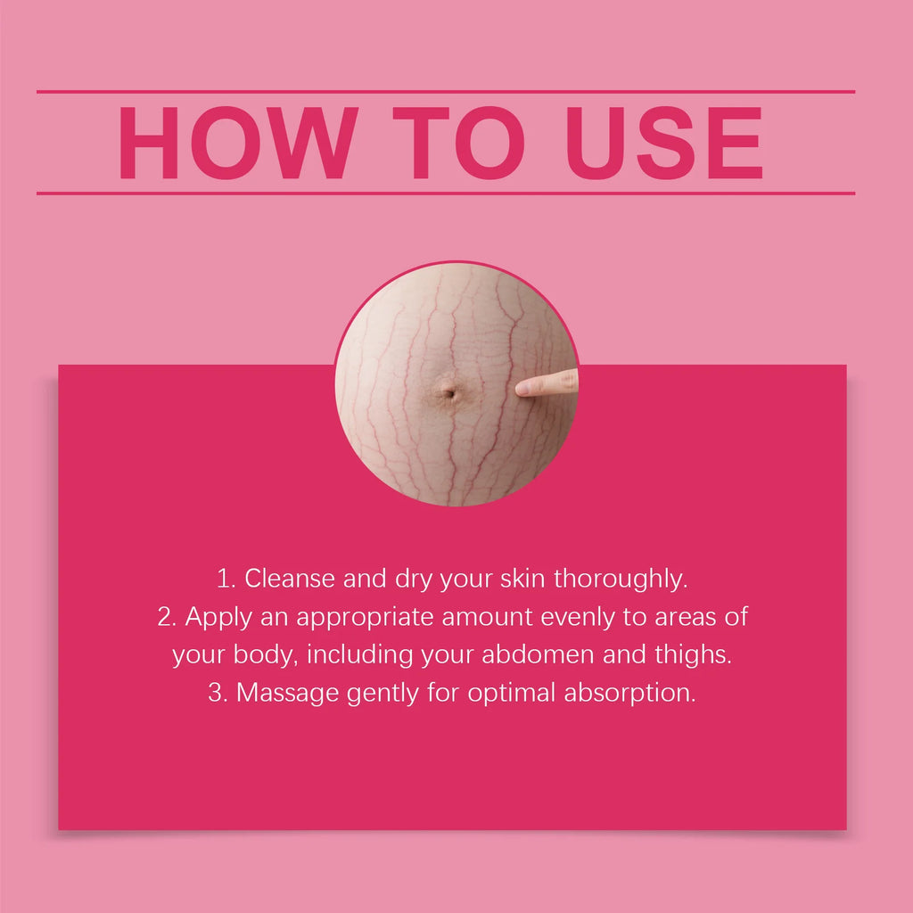 OceAura Pregnancy Stretch Mark Cream — Deep Hydration, Skin Regeneration & Non-Greasy Formula 100g