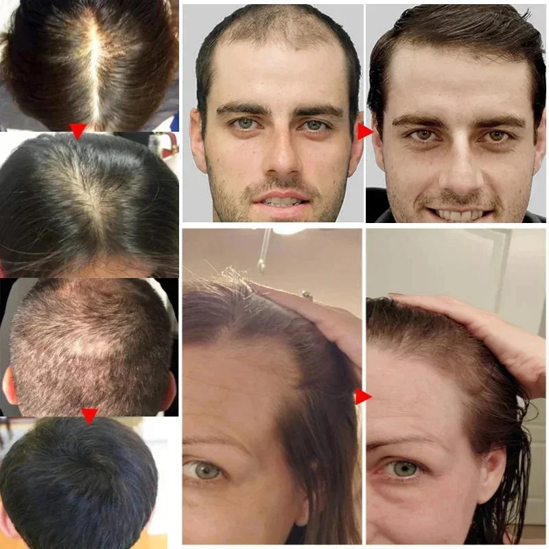Black Rice Fast Hair Growth Serum Spray for Men Women Anti-loss Hair Regrowth Essential Oil Scalp Treatment Hair Care Products