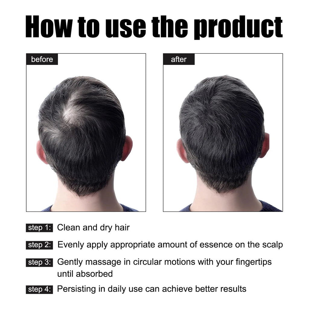 East Moon Men's Hair Growth Essence 30ml — Strengthen, Nourish & Prevent Hair Loss - Authority Asset Brand