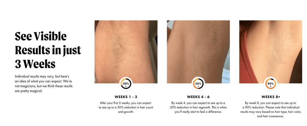 IPL Laser Hair Removal Device with Ice Cooling - Authority Asset Brand