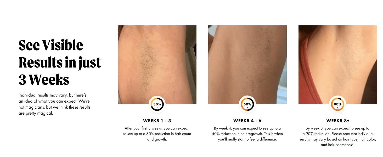 IPL Laser Hair Removal Device with Ice Cooling - Authority Asset Brand