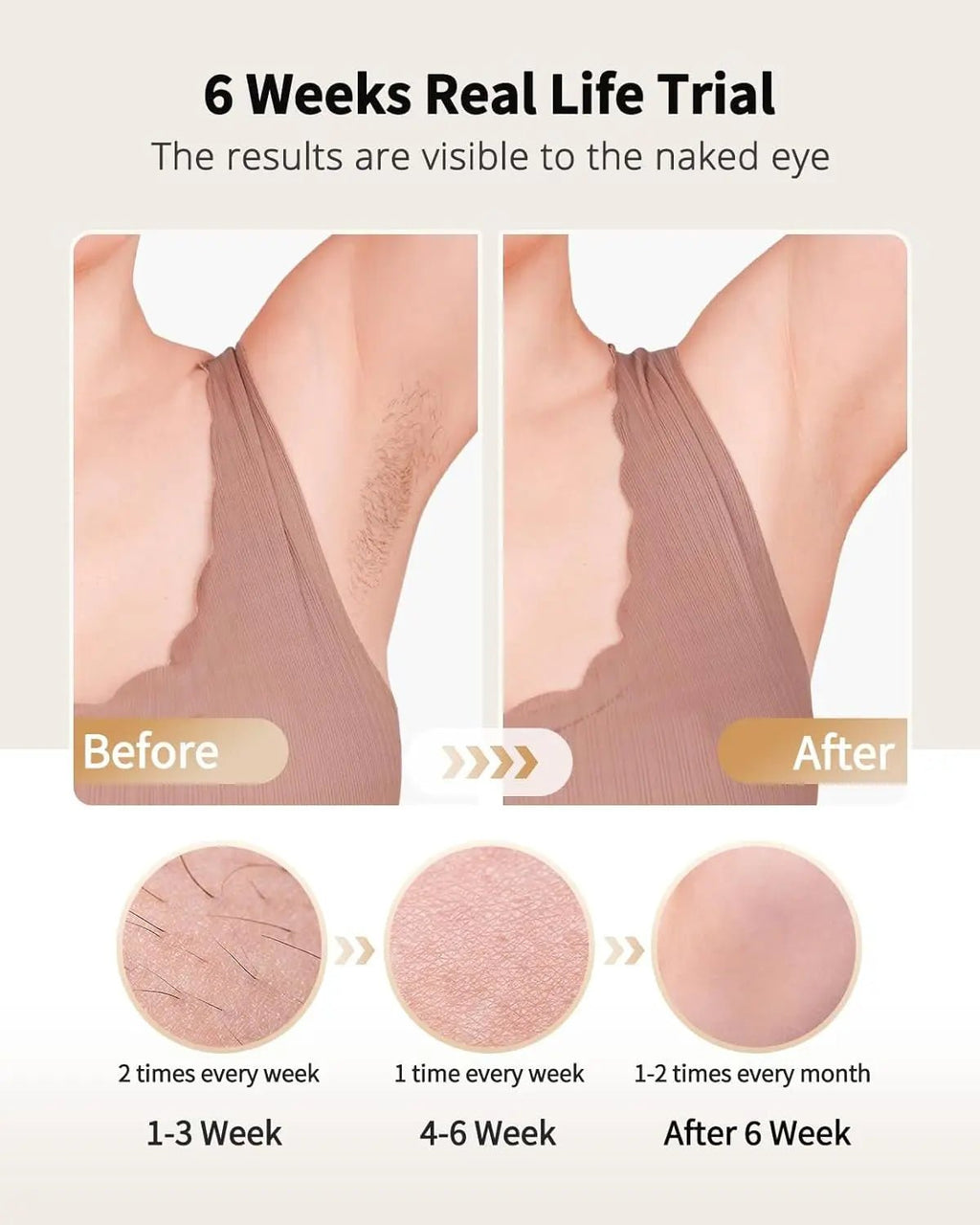 IPL Laser Hair Removal Device with Ice Cooling - Authority Asset Brand
