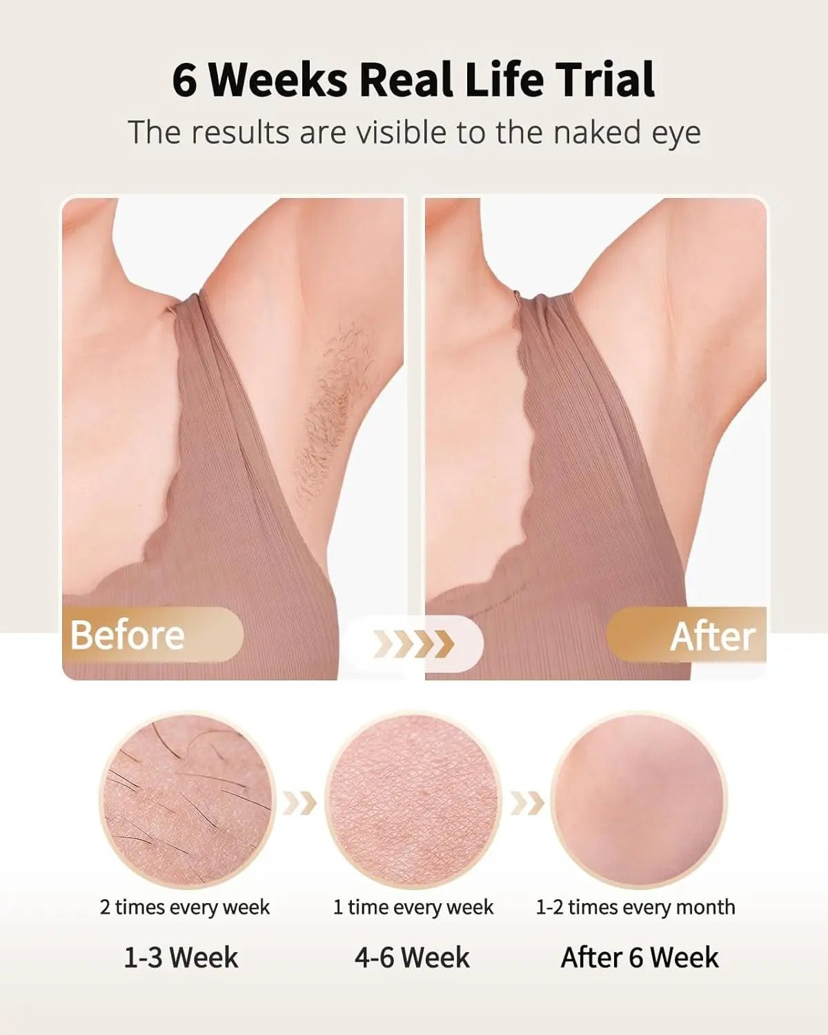 IPL Laser Hair Removal Device with Ice Cooling - Authority Asset Brand